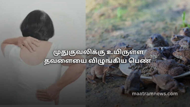 முதுகுவலிக்கு உயிருள்ள தவளையை விழுங்கிய பெண்
