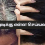 What Can Be Done for Grey Hair?