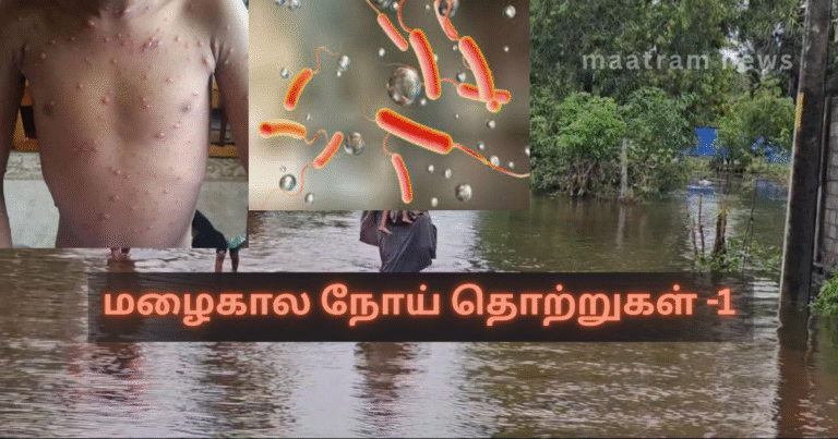 Monsoon Season Infections – 1