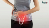 கர்ப்பப்பை நீர்கட்டி (PCOS) என்றால் என்ன? பெண்கள் கட்டாயம் தெரிந்து கொள்ள வேண்டியவை