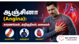 ஆஞ்சினா (Angina): காரணங்கள், அறிகுறிகள், வகைகள்